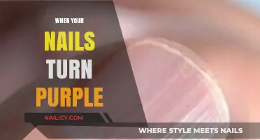 Why Your Nails Turn Purple: Causes, Concerns, and Solutions Explained