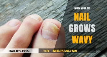 Why Does My Toenail Grow Wavy?