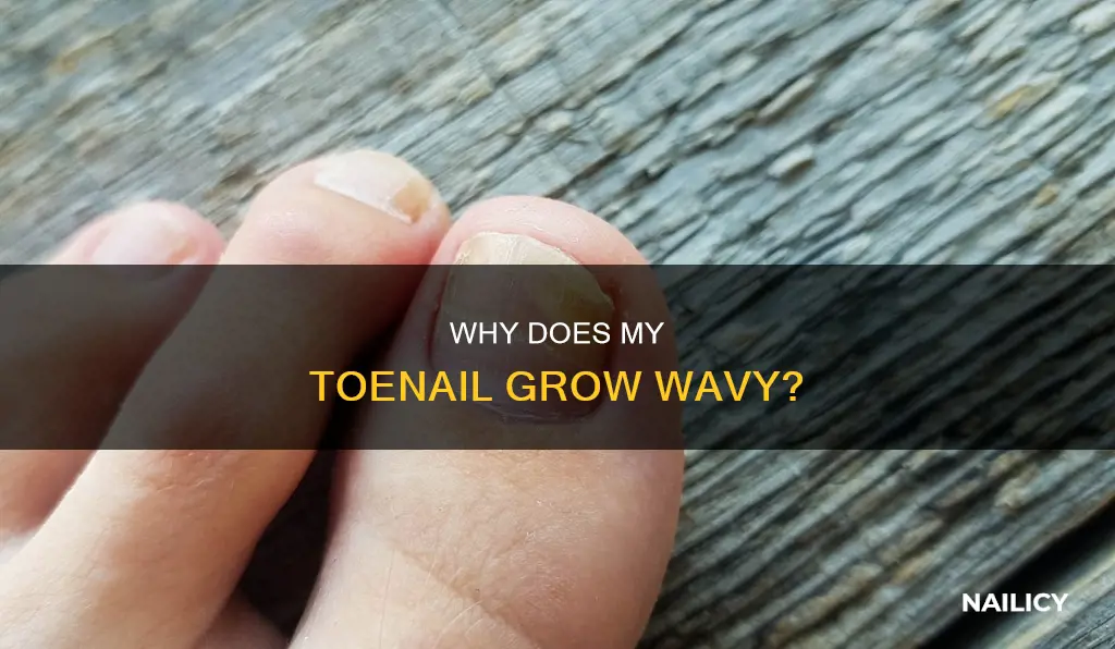 when your tie nail grows wavy