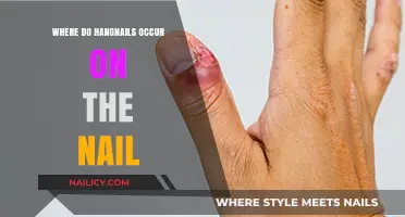 Where Hangnails Form: Understanding Their Location on Your Nails