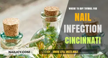 Where to Buy Thymol for Nail Infections in Cincinnati