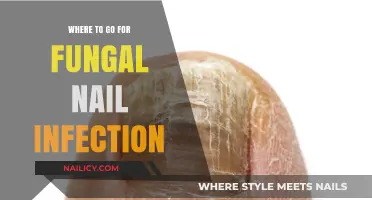 Effective Treatment Options for Fungal Nail Infections: Where to Go