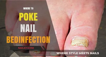 Treating Nail Bed Infections: Safe and Effective Poke Locations Guide