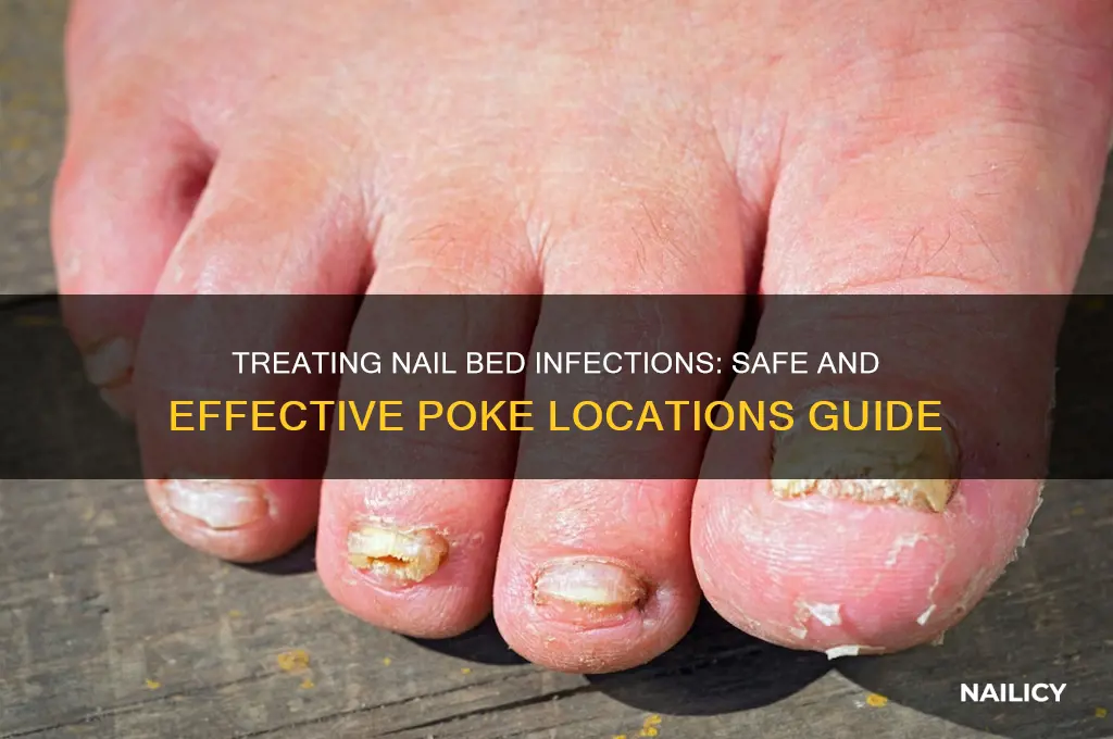 where to poke nail bedinfection