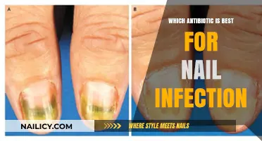 Effective Antibiotics for Treating Nail Infections: Top Options and Recommendations