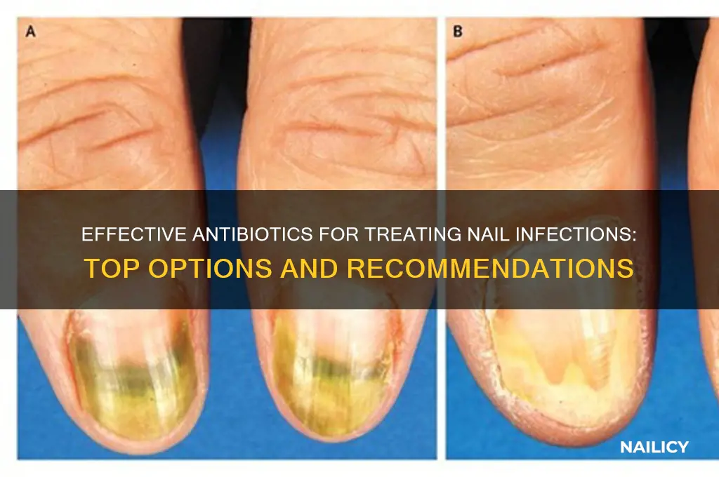 which antibiotic is best for nail infection