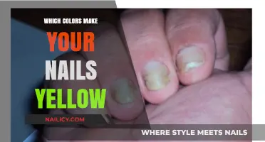 Why Your Nails Turn Yellow: Culprit Colors and Prevention Tips