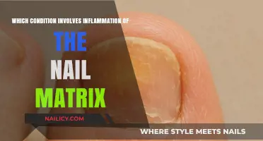 Inflammation of the Nail Matrix: Understanding the Condition and Symptoms