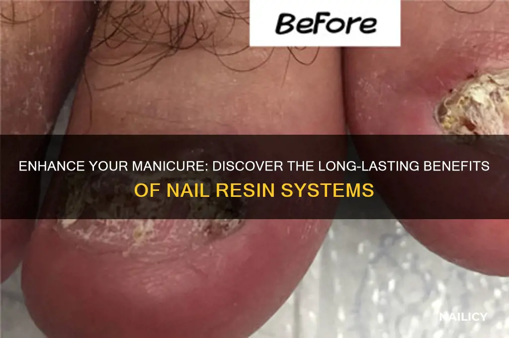 which is a benefit of nail resin systems