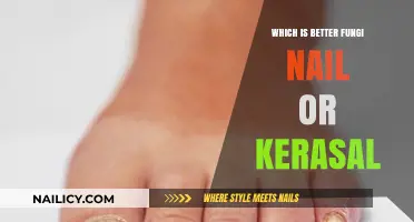 Fungi Nail vs. Kerasal: Which Treatment Works Best for Toenail Fungus?