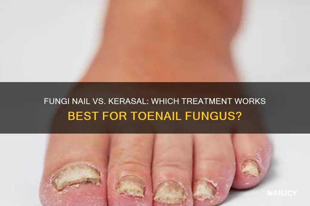 which is better fungi nail or kerasal