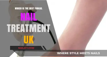 Top UK Fungal Nail Treatments: Effective Solutions for Healthy Nails