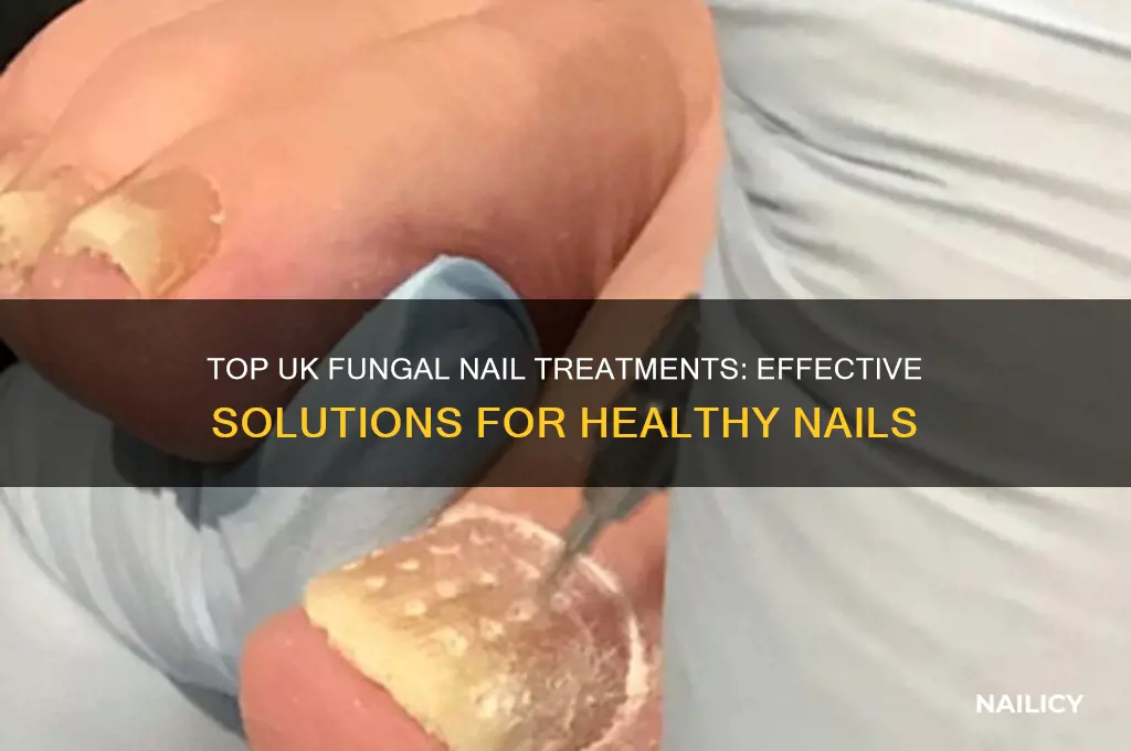which is the best fungal nail treatment uk