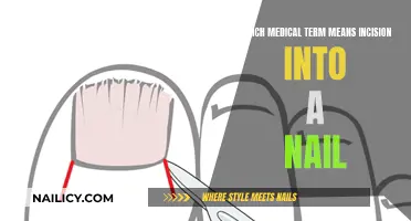 Understanding the Medical Term for Nail Incision: A Comprehensive Guide