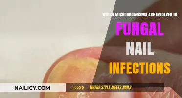 Unveiling the Microbial Culprits Behind Persistent Fungal Nail Infections