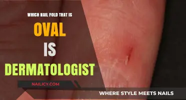 Oval Nail Folds: Dermatologist Insights on Identification and Health