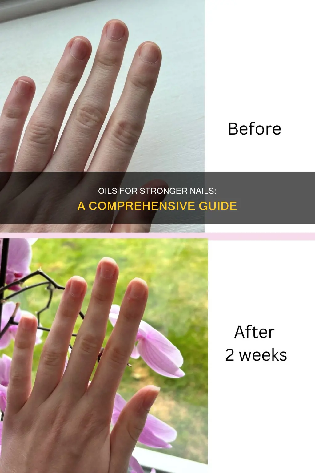 which oil grows nails