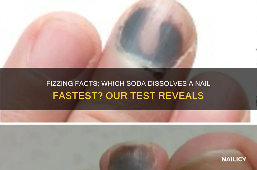 which soda dissolves a nail the fastest
