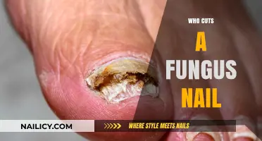 Podiatrists: Your Fungal Nail Solution