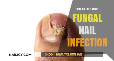 Who to Consult for Fungal Nail Infections: Expert Treatment Options