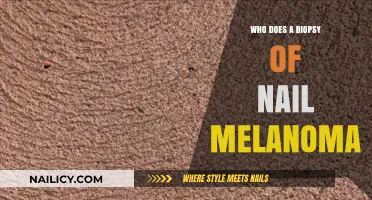 Who Performs Nail Melanoma Biopsies: Understanding the Procedure and Specialists