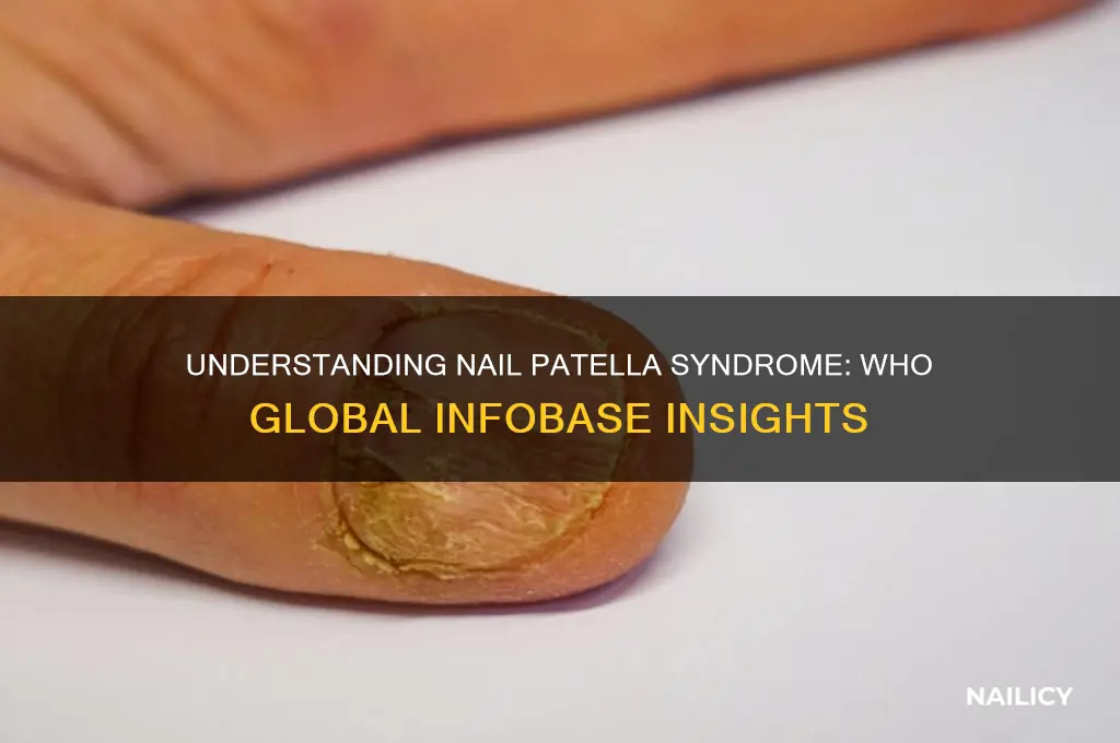who global infobase nail patella
