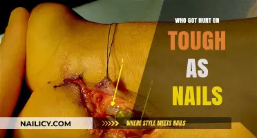 Tough as Nails Injuries: Who Got Hurt on the Show?