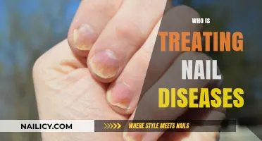 Who Treats Nail Diseases? Understanding Podiatrists and Dermatologists' Roles