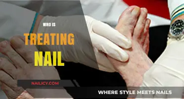 Who is Treating Nail? Expert Care for Healthy Nails Explained