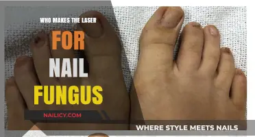 Who Manufactures the Laser Treatment for Nail Fungus Infections?