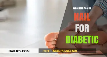 Diabetics: Nail Care to Avoid Infections