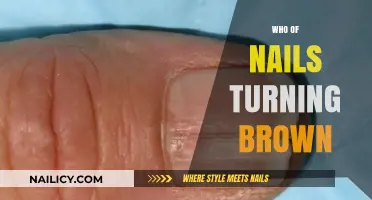 Why Are My Nails Turning Brown? Causes and Solutions Explained