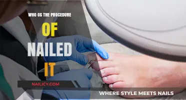 Mastering the Nailed It Procedure: A Step-by-Step Guide to Success