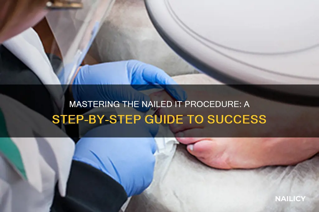 who os the procedure of nailed it