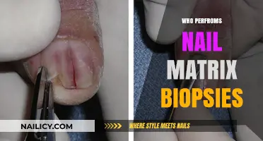 Who Performs Nail Matrix Biopsies: Expert Roles and Procedures