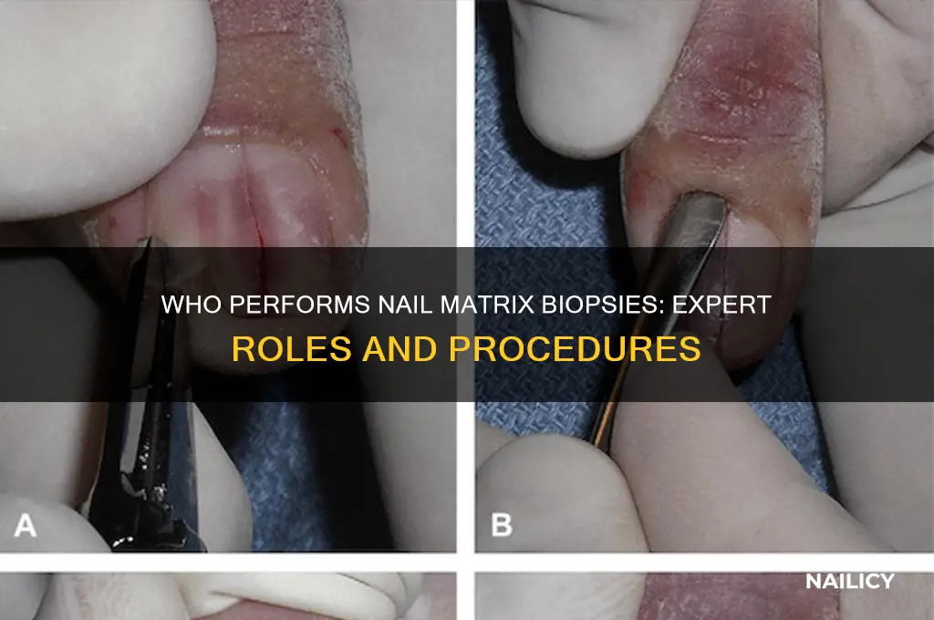 who perfroms nail matrix biopsies