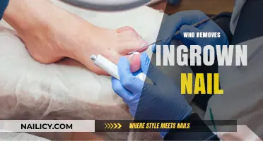 Podiatrists: Your Ingrown Nail Removal Experts