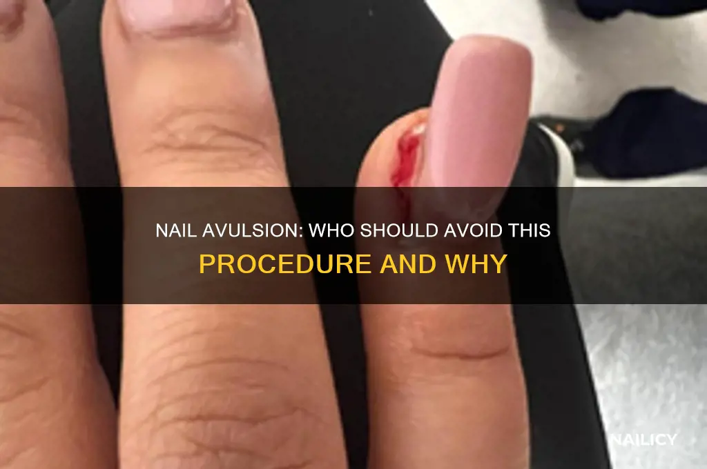 who should not have a nail avulsion
