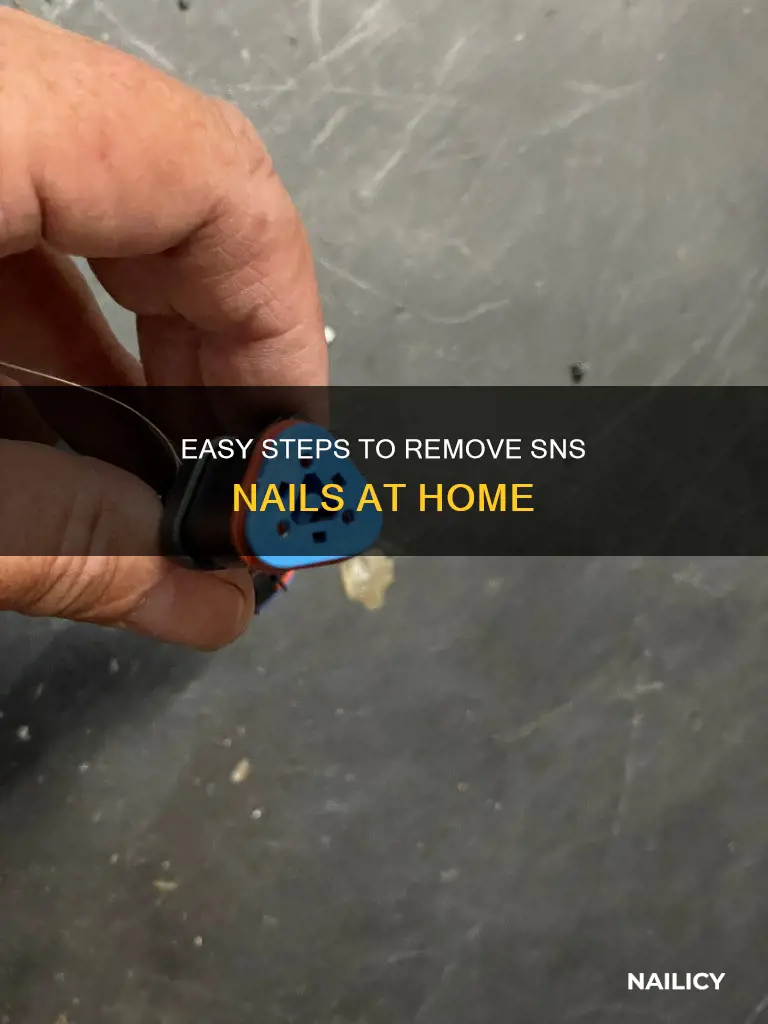who to remove nsn nails