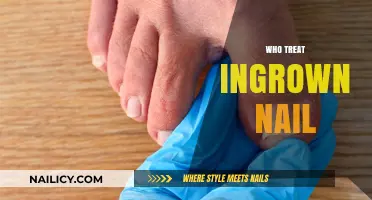 Who Treats Ingrown Nails? Expert Care Options Explained