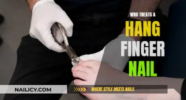 Treating a Hangnail: When to See a Doctor