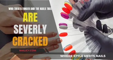 Podiatrist and Dermatologist: Cracked Nails' Ultimate Solution