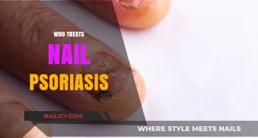 Who Treats Nail Psoriasis? Expert Care Options Explained