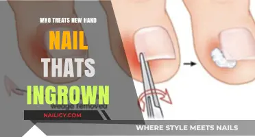 Who Treats Ingrown Hand Nails? Expert Care Options Explained