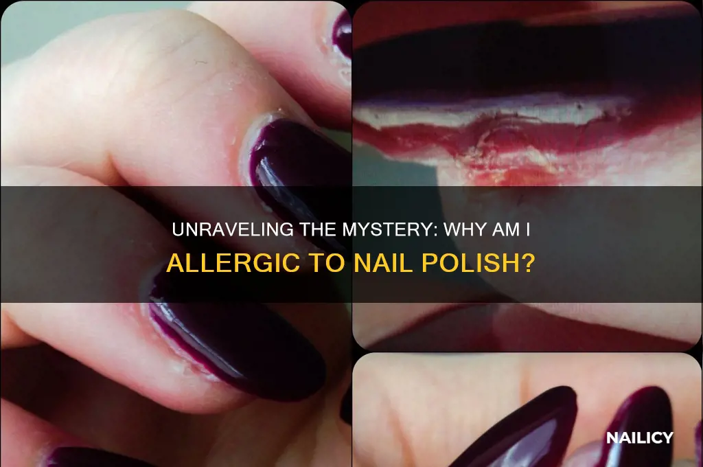 why am i allergic to nail polish