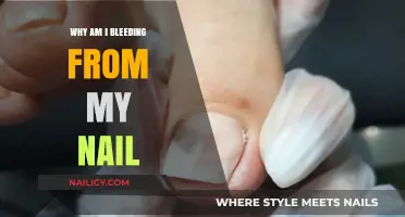 Why Am I Bleeding from My Nail? Causes and Solutions Explained