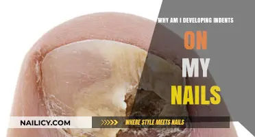 Why Are Indents Forming on My Nails? Causes and Solutions