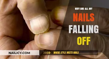Why Are My Nails Falling Off? Causes and Solutions Explained