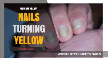Why Are My Nails Turning Yellow? Causes and Solutions Explained