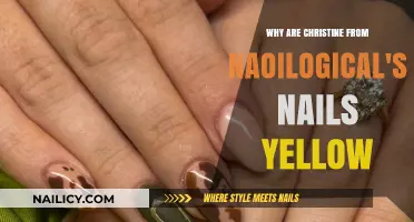 Why Christine's Nails Are Yellow: Naillogical's Secret Revealed
